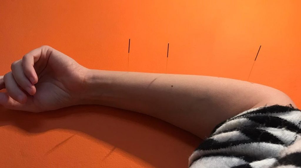 Master Visuddhi Lee Chang Men 33.10, Gan Men 33.11, Xin Men 33.12 acupuncture points: